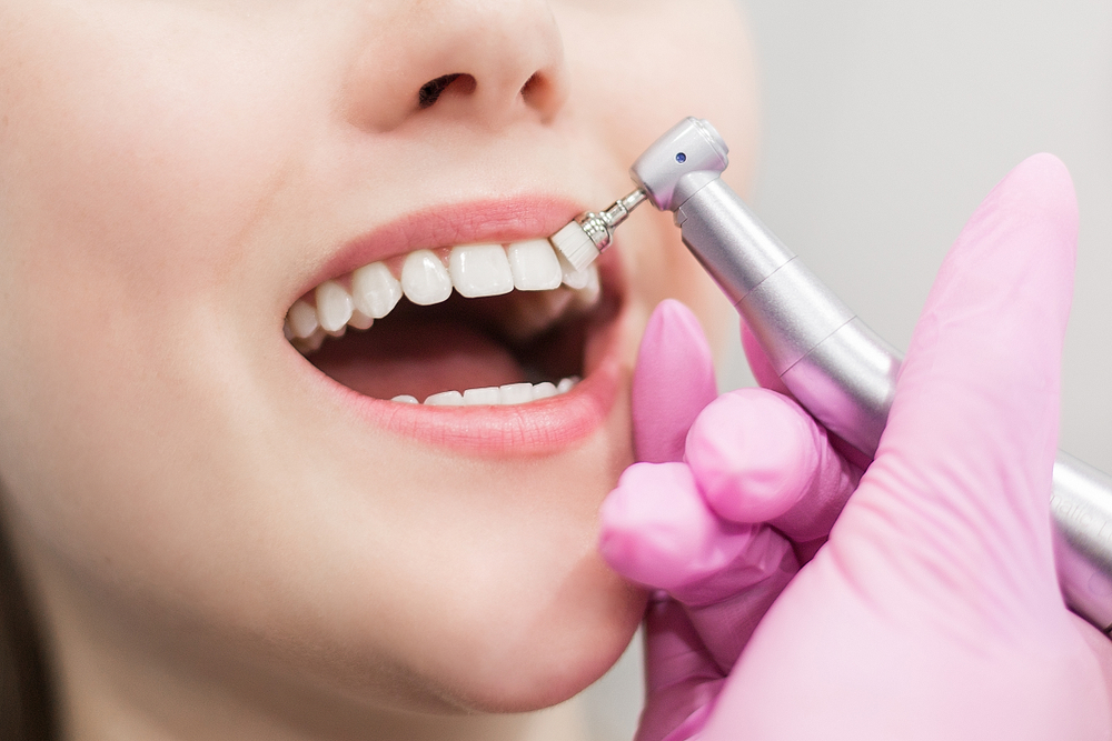 Dental Hygienist Cleaning Tools Used During A Hygiene Appointment